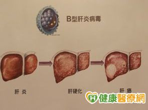 永不停歇的愛紀錄片 即將於台大首映-焦點人物 永不停歇的愛紀錄片 即將於台大首映-焦點人物