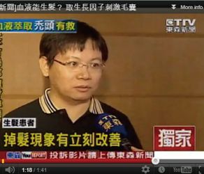 血液能生髮!取生長因子刺激毛囊!!-醫護新鮮事